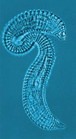 Physalia Meiofaunal Services Unit; Metepsilonema - Nematoda 